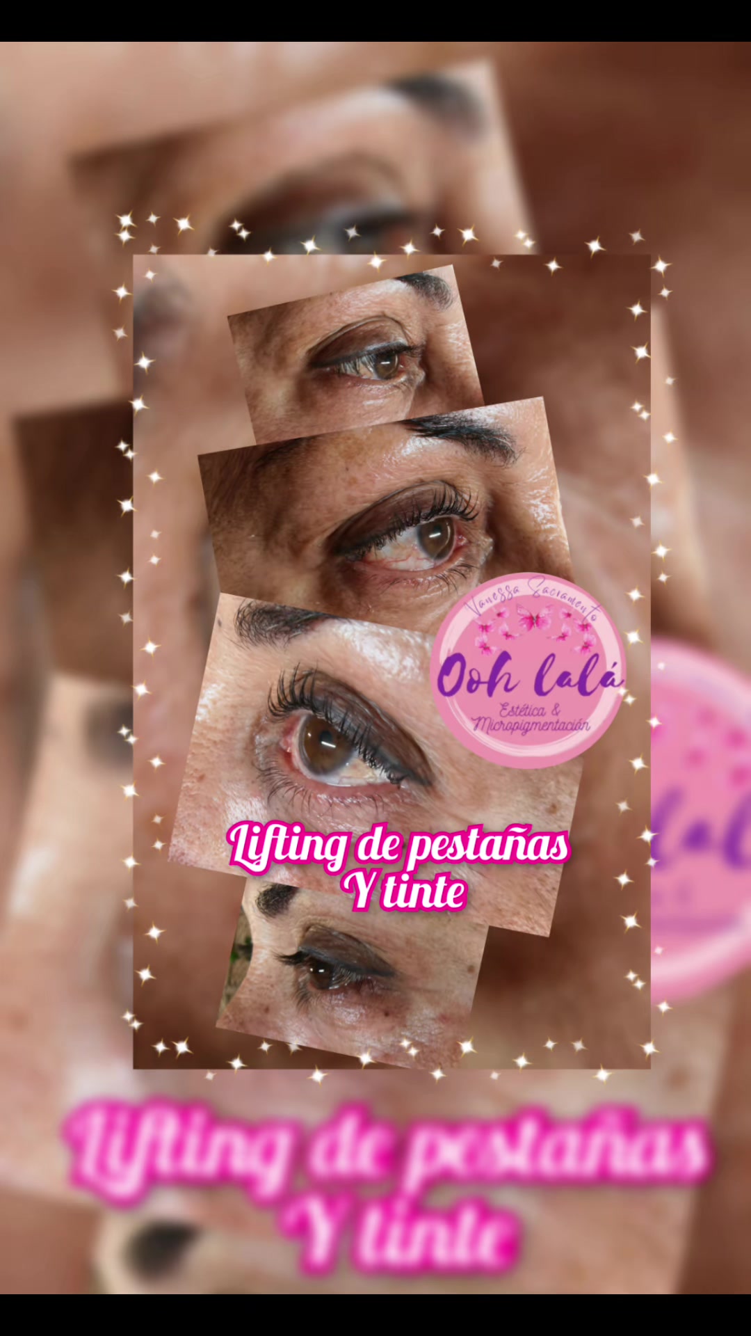 @Oohlal&aacute; Est&eacute;tic