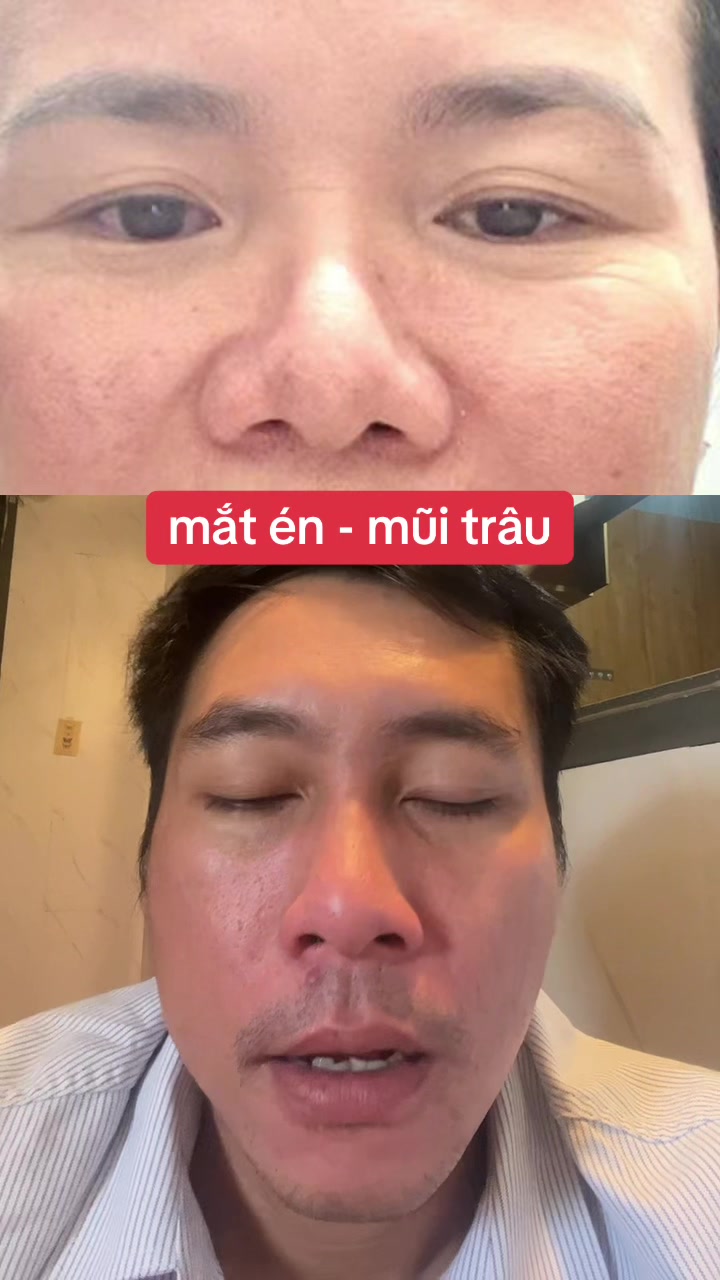 @Tuệ Nhãn ✅