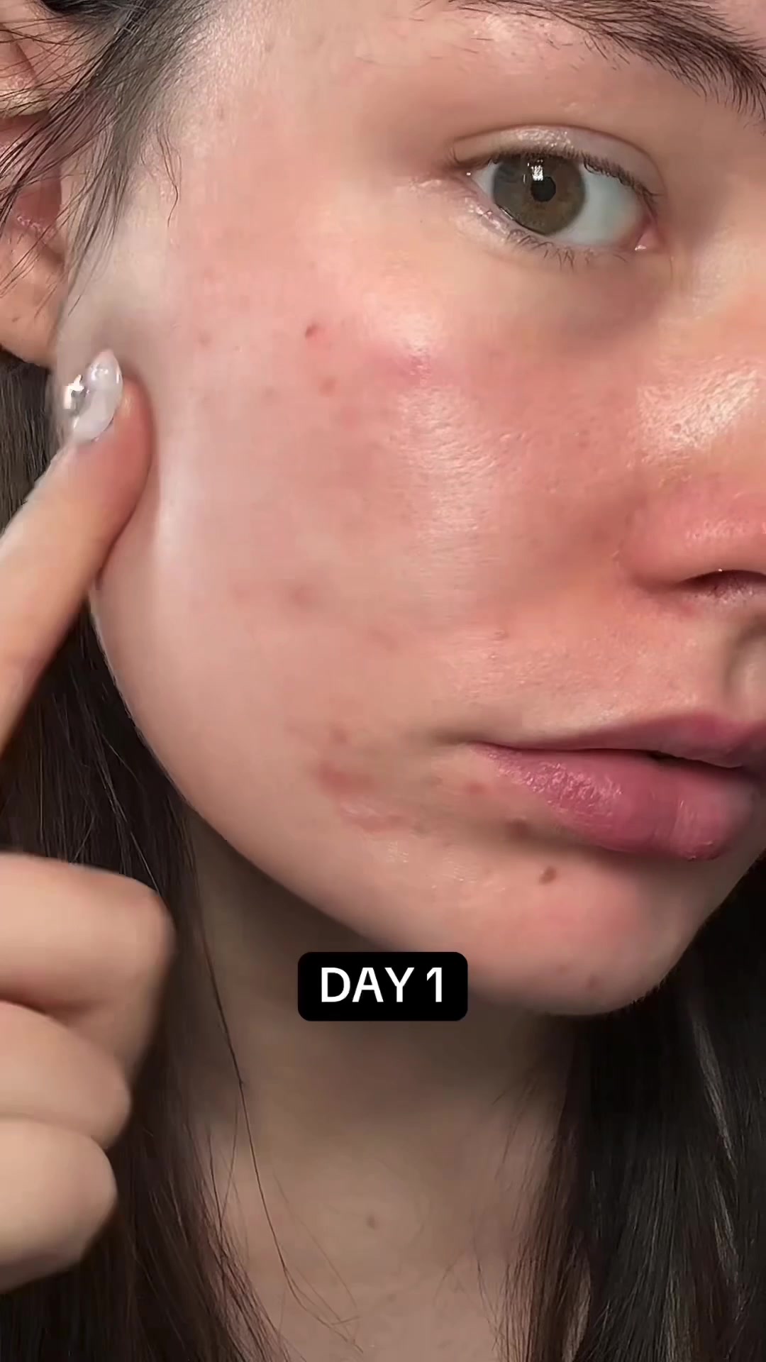@watermelonsugarskin