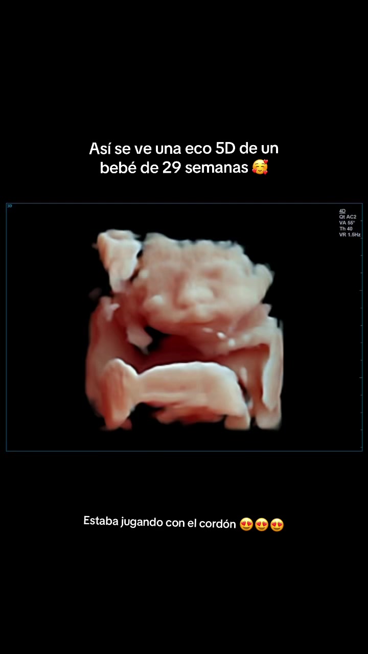 @Pelipecas