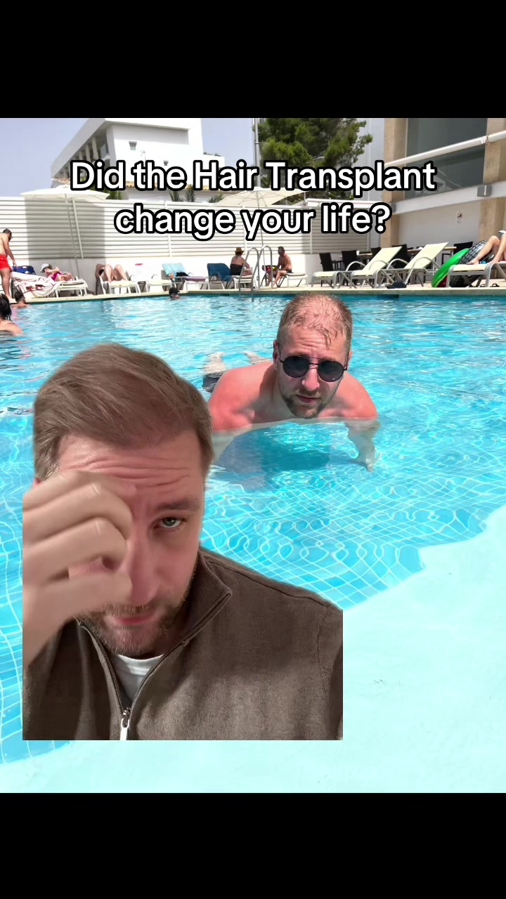 @Mr. Hairtransplant