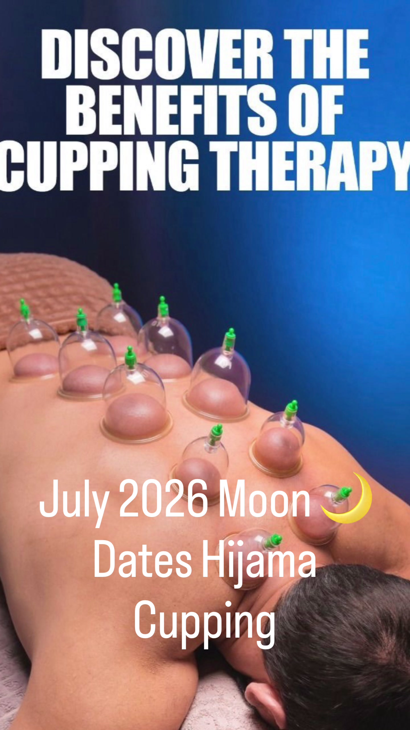 @Rashid 🇿🇦 🇵🇰Hijama Cupping