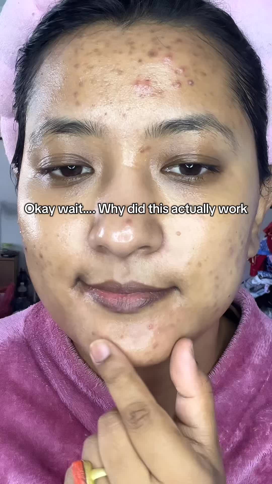@Anuradha