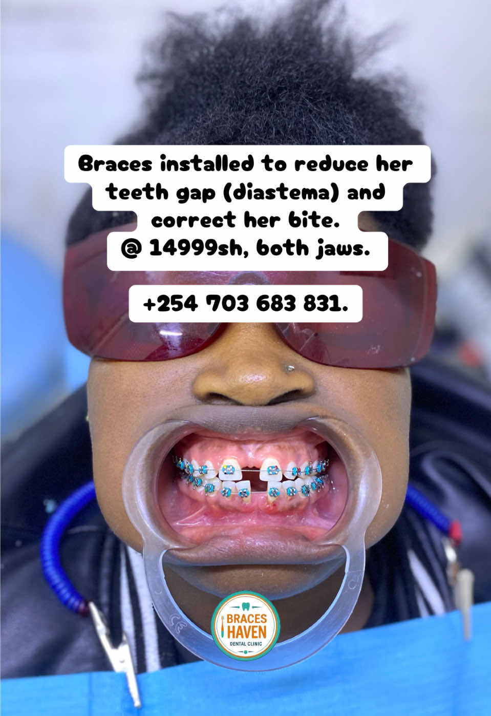 @Braces Haven Nairobi Dental