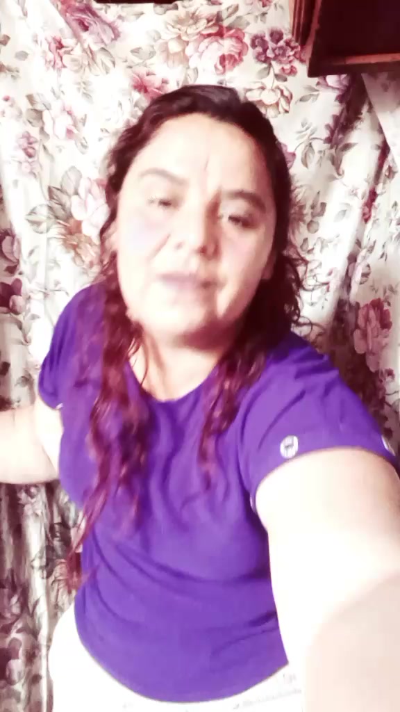 @🥰yarelypacheco😍 🦿