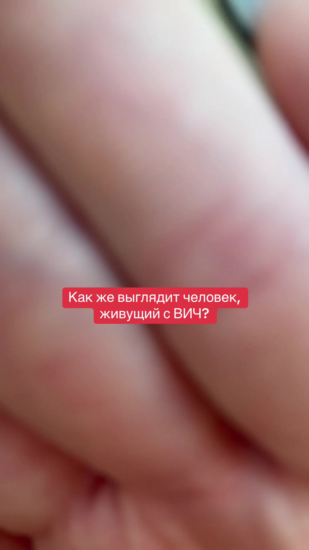 @LiveHiv