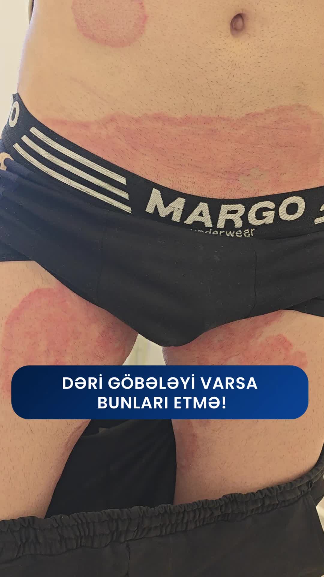@Dr.Eldar Məmmədov