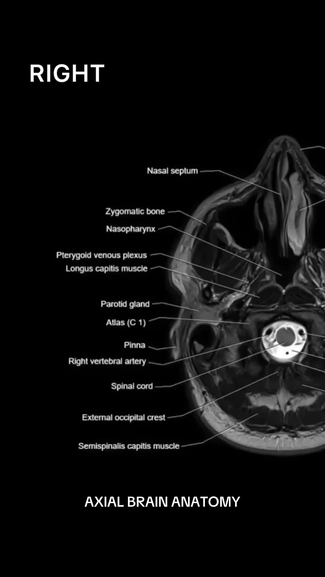@Sobat Radiology