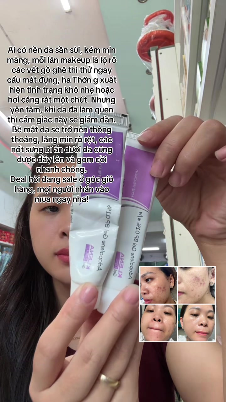 @Hoa Acne Skincare🌷