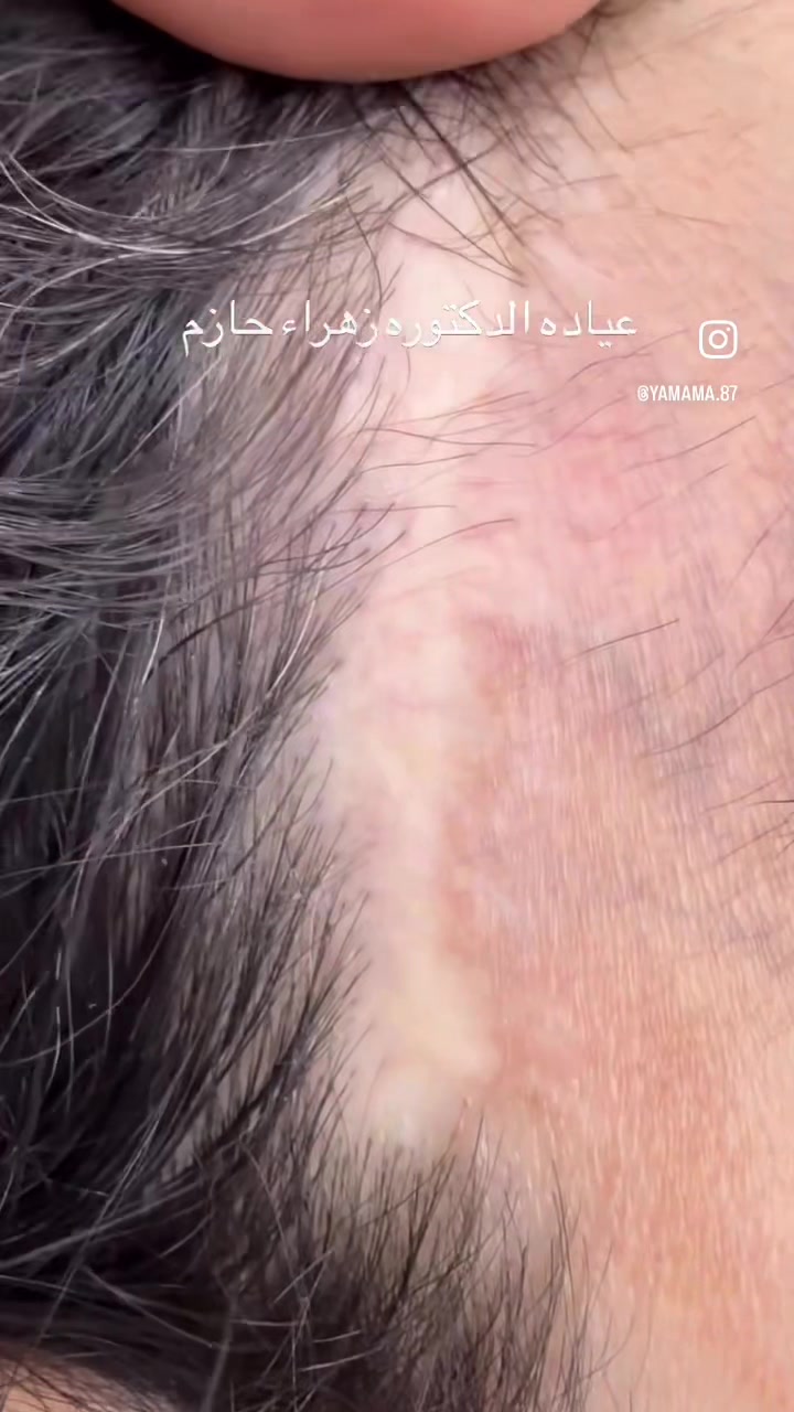 @الدكتورة زهراء حازم