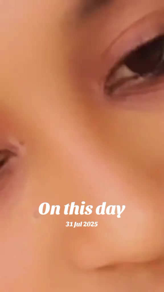 @Bikiltu 21