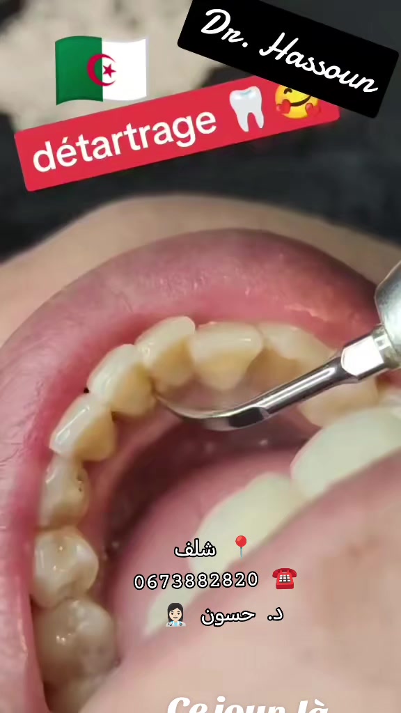 @Dr HASSOUN02 طبيبة الاسنان شلف