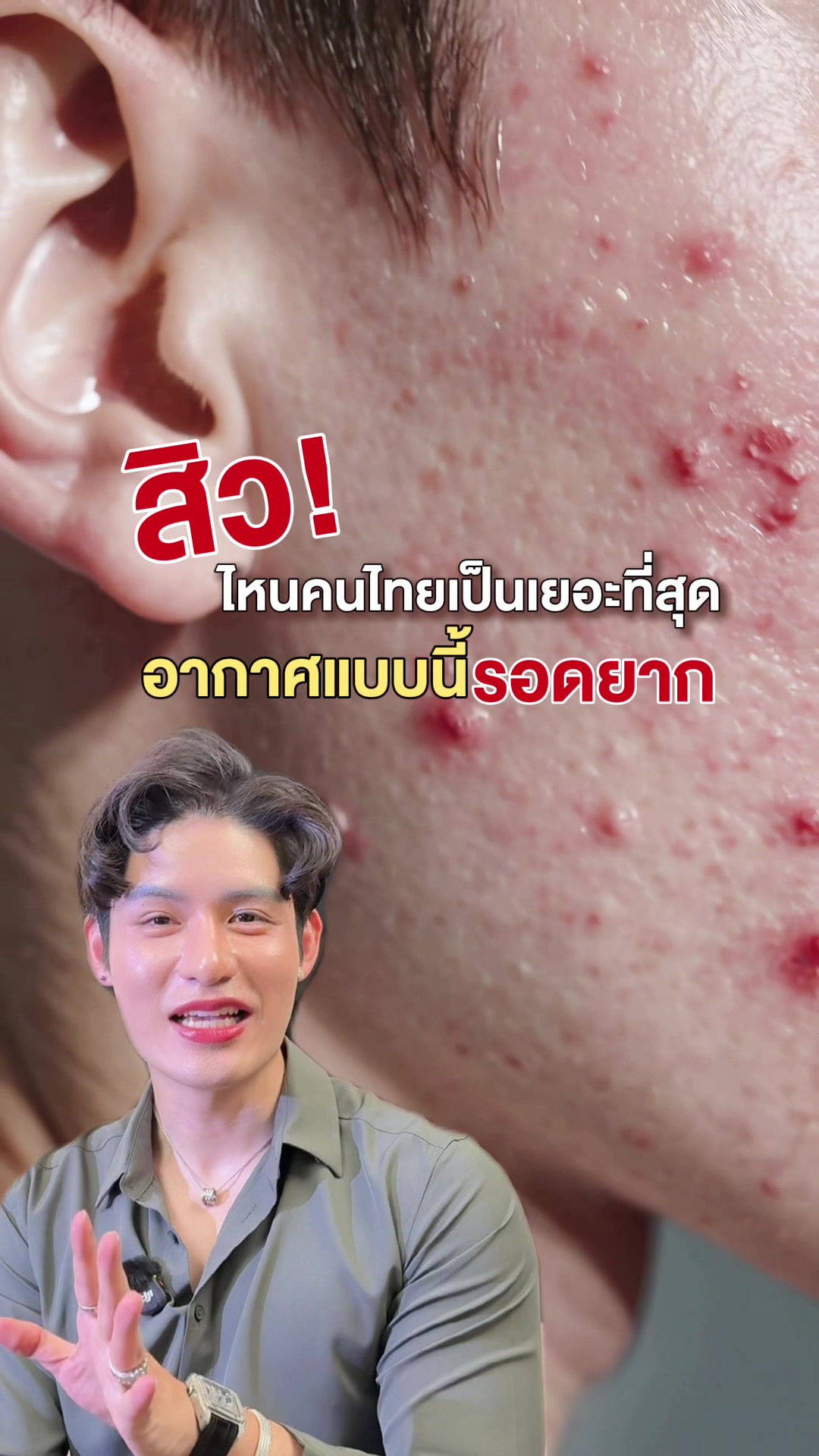 @หนูปอนด์ที่ชอบเลเซ่อร์