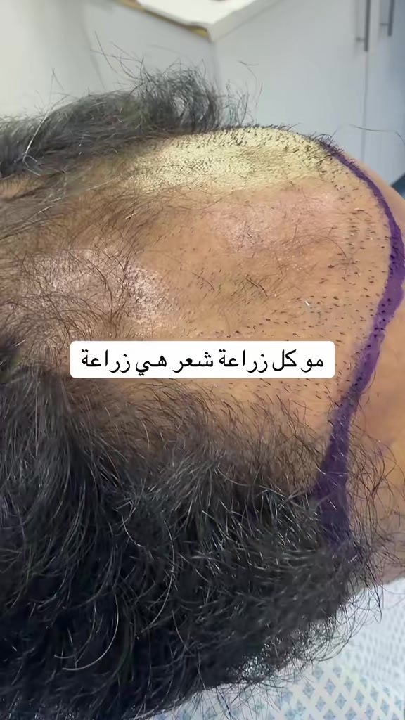 @Dr. Ahmed Alkhateeb