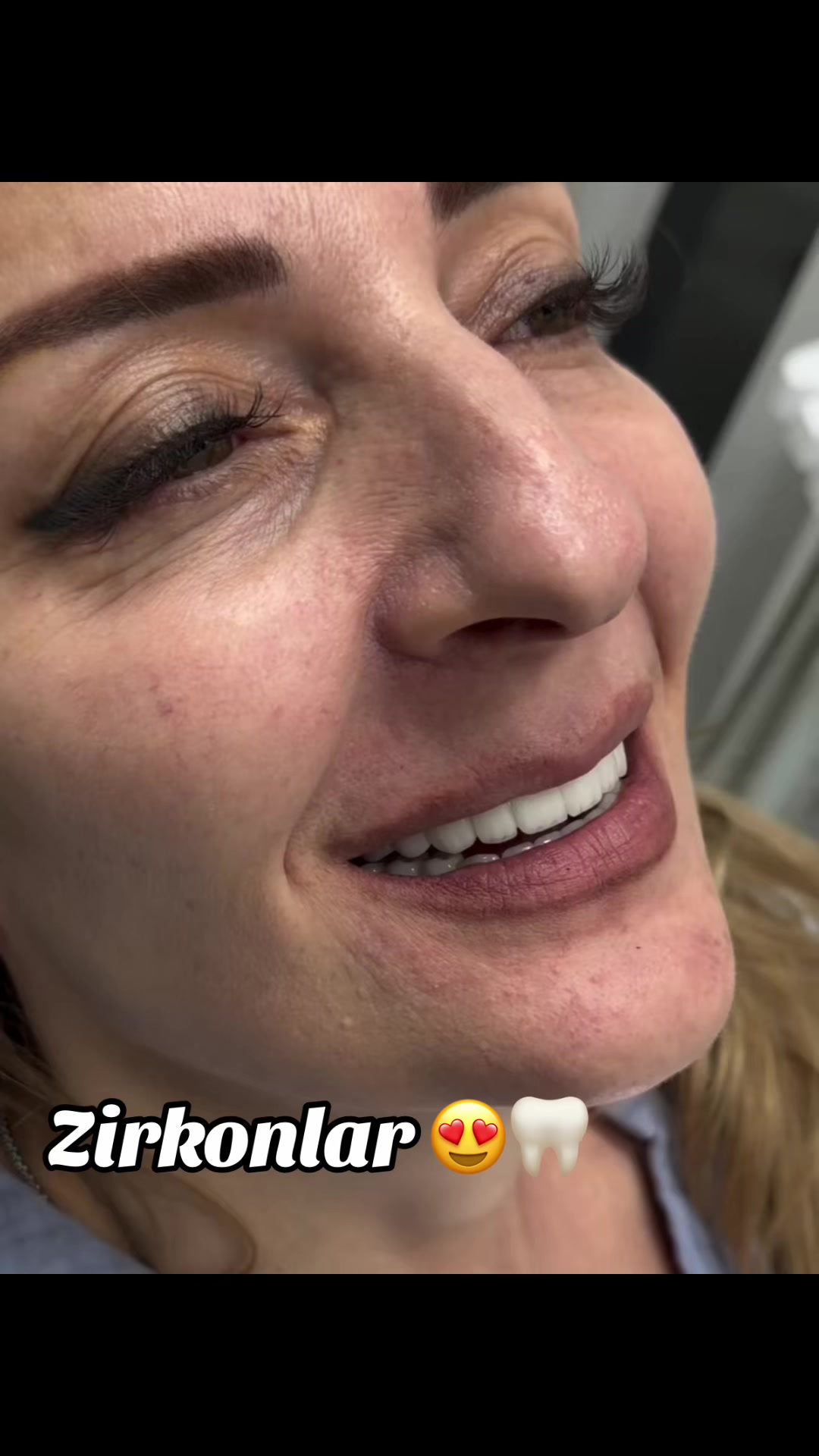 @𝐁𝐚𝐲𝐃𝐞𝐧𝐭𝐄𝐥𝐢𝐭𝐞 🦷