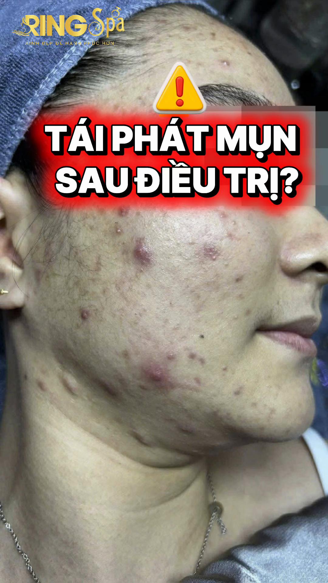 @Ring_Spa