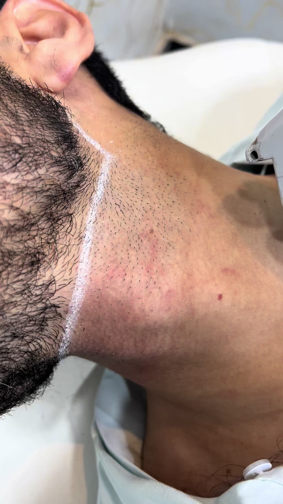 @Laser Grafix clinic