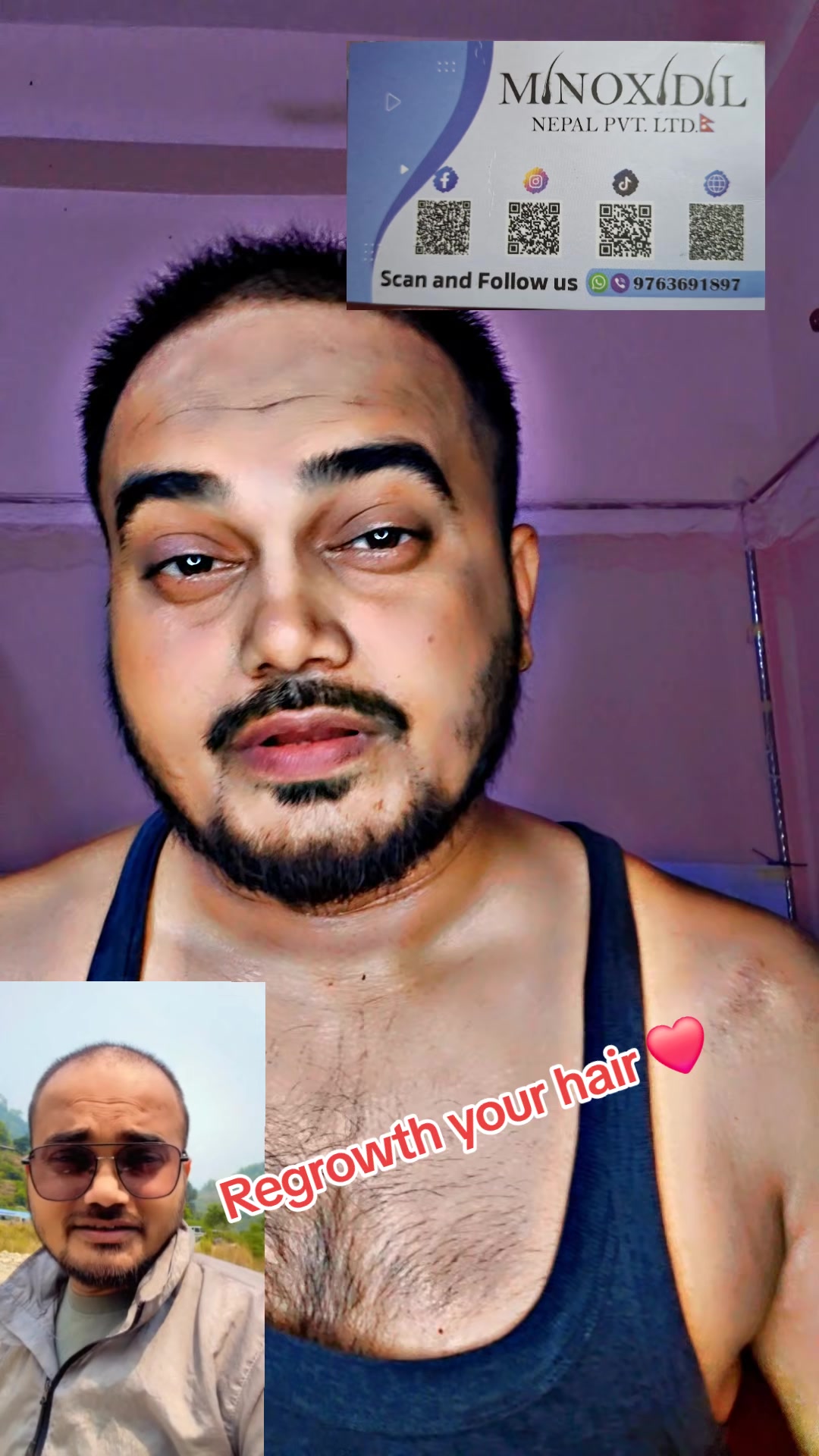 @DipeshSingh.             🕸🕷