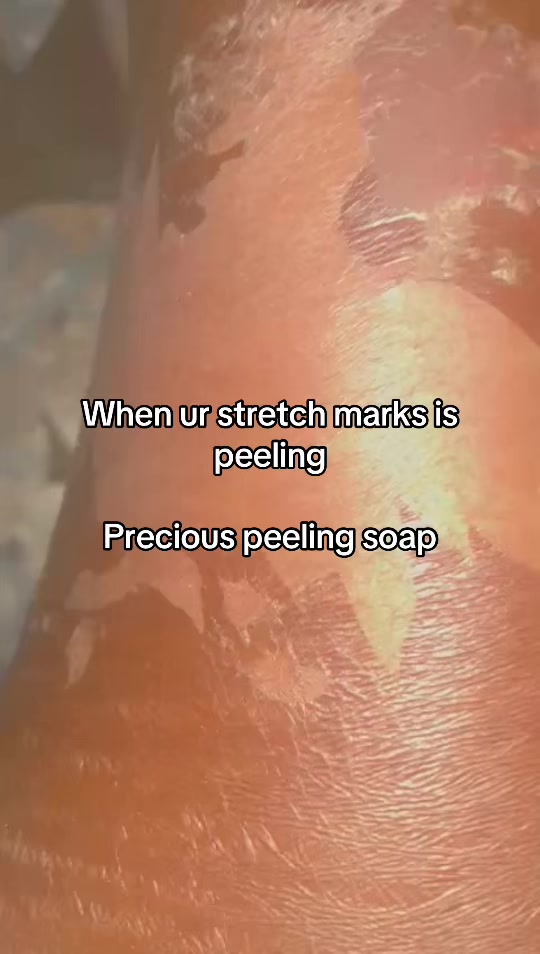 @@ Precious peeling soap