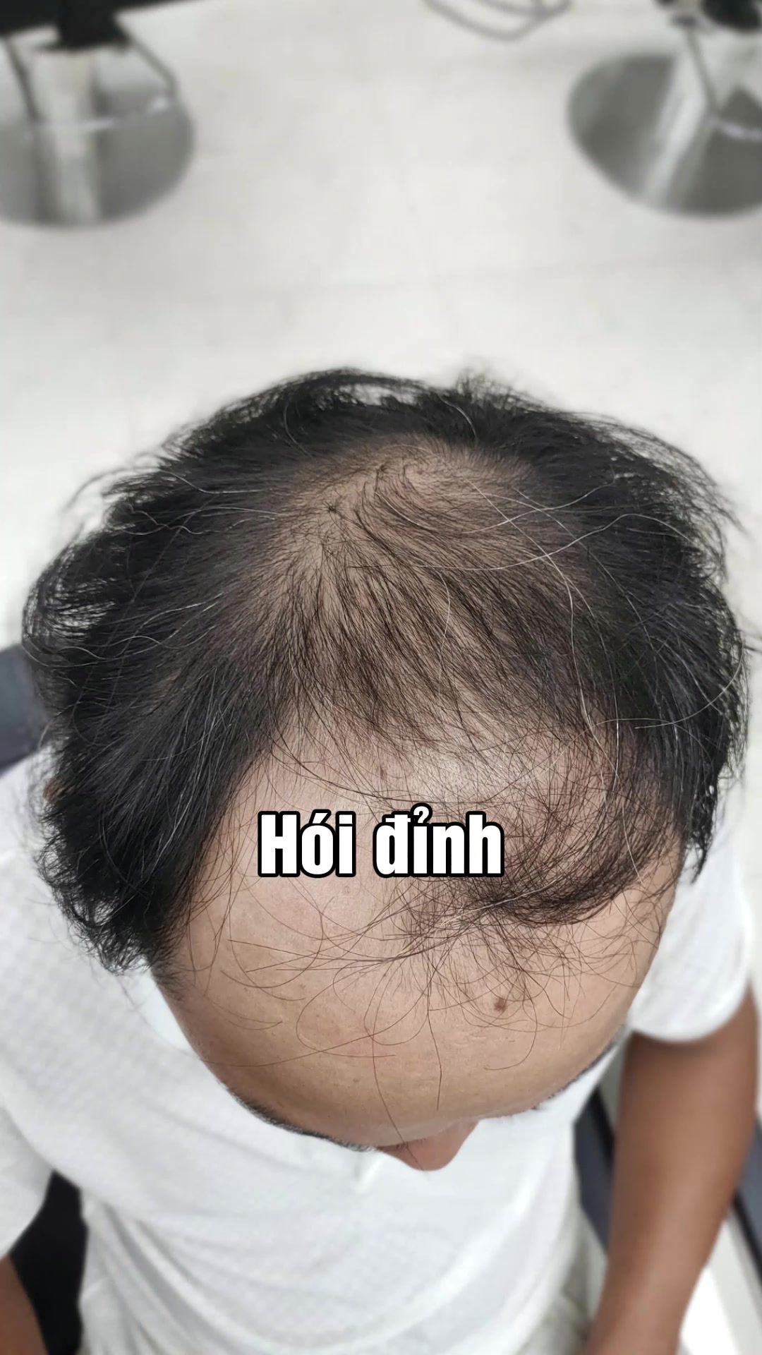 @Togi Hair - Tóc Giả Thiết Kế