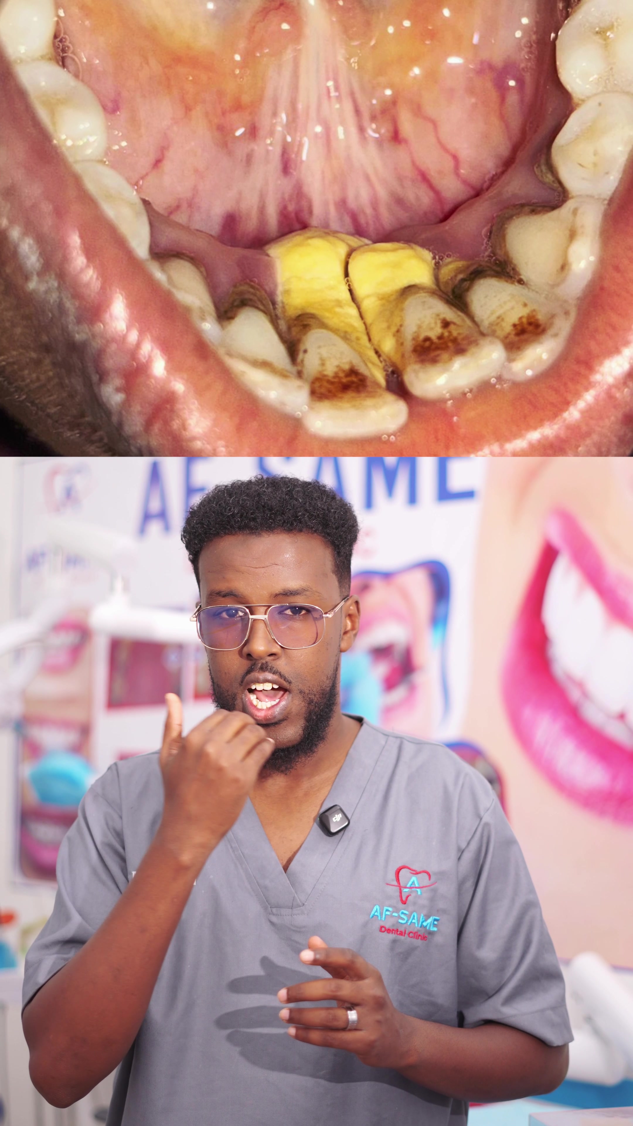 @Dr. Maano 🦷