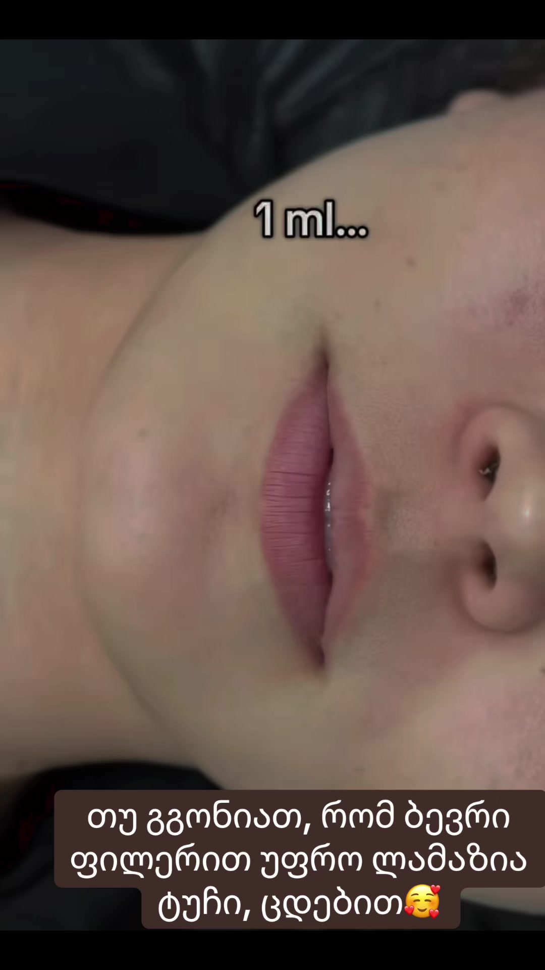 @Likuna mantskava