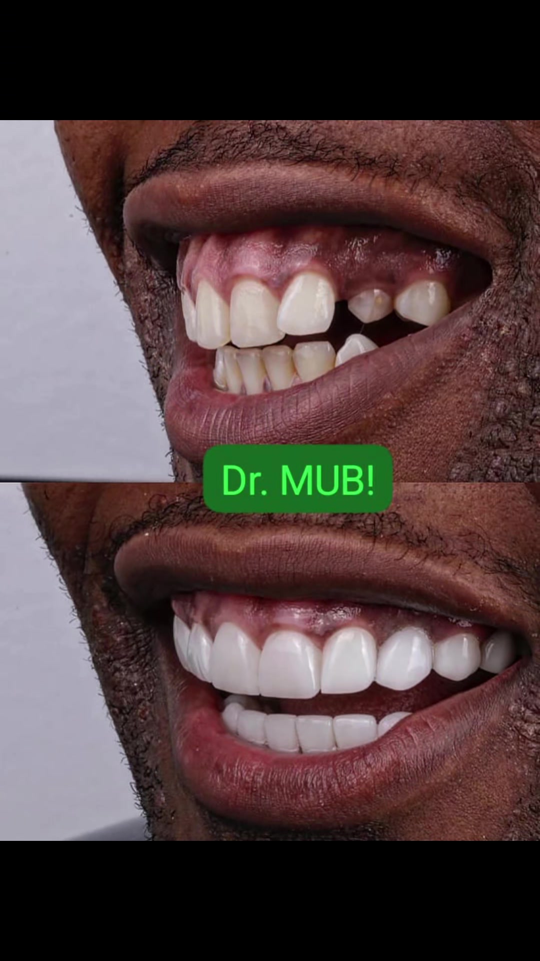 @Mub 🇺🇬