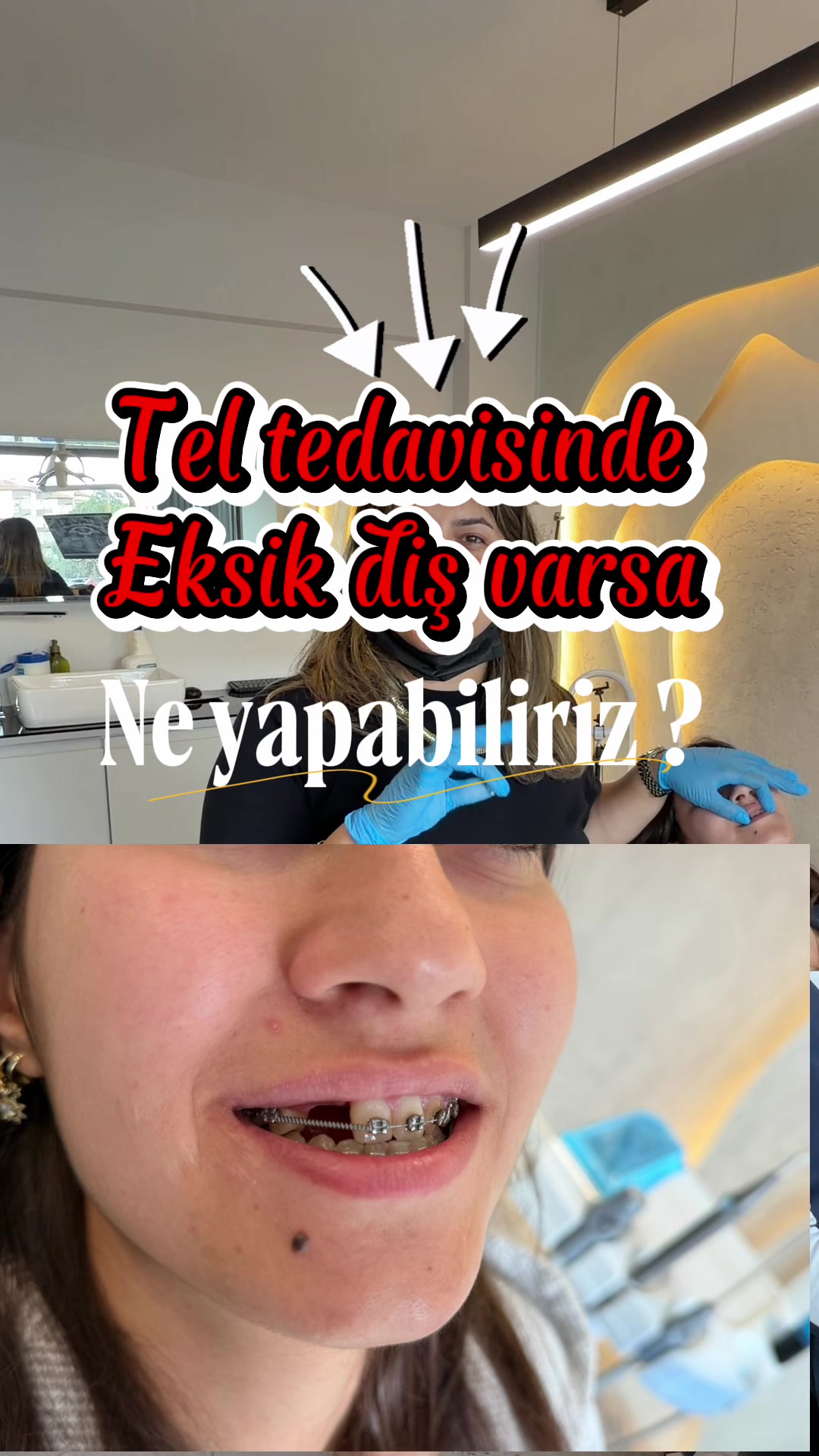 @Diş Hekimi Handenur Duru