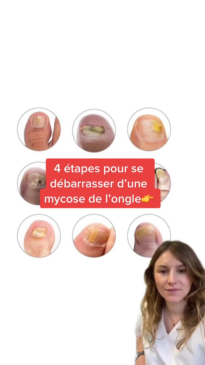 @PODERM