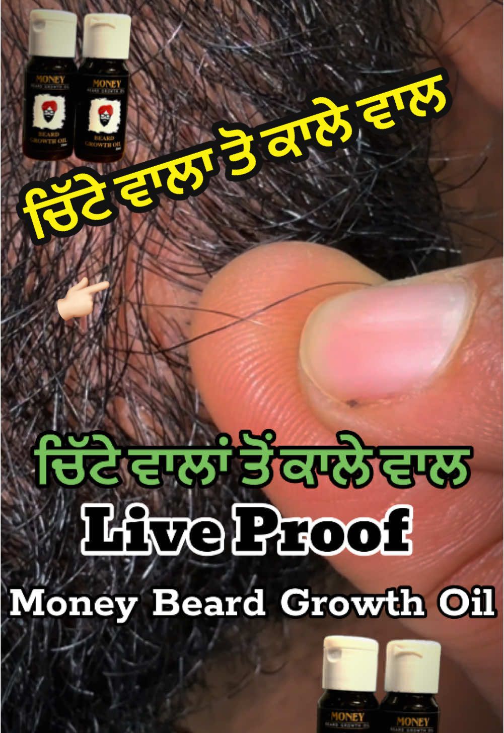 @money_beard_growthoil