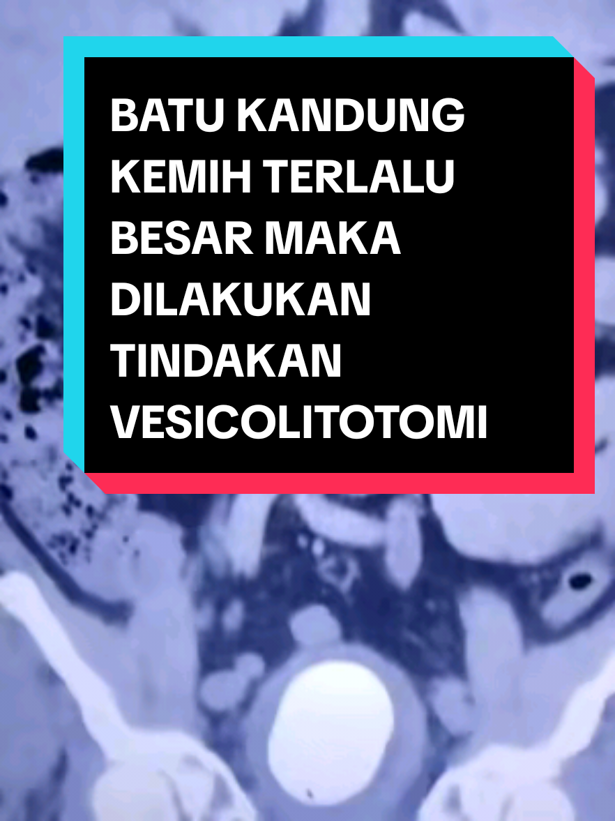 @KAMAR OPERASI