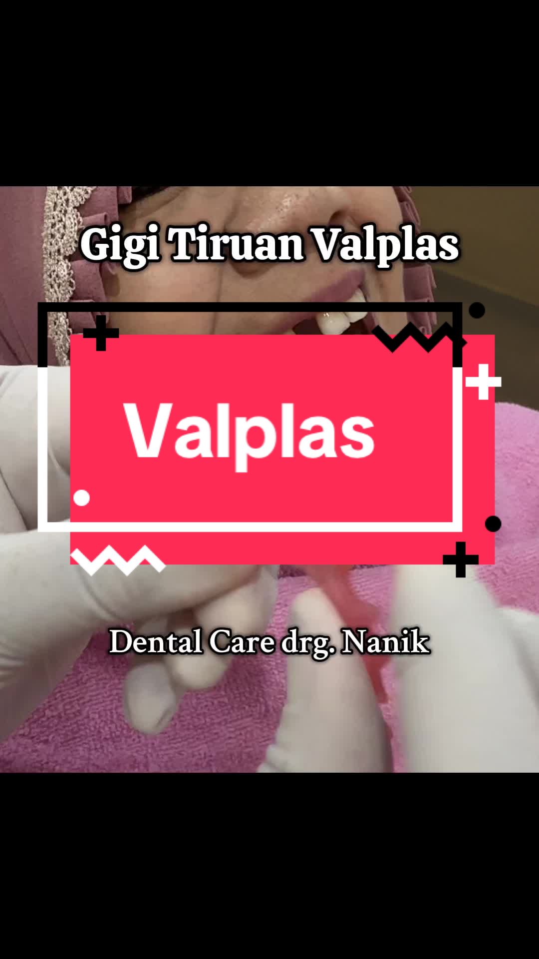 @drg Nanik MARS Keden Pedan