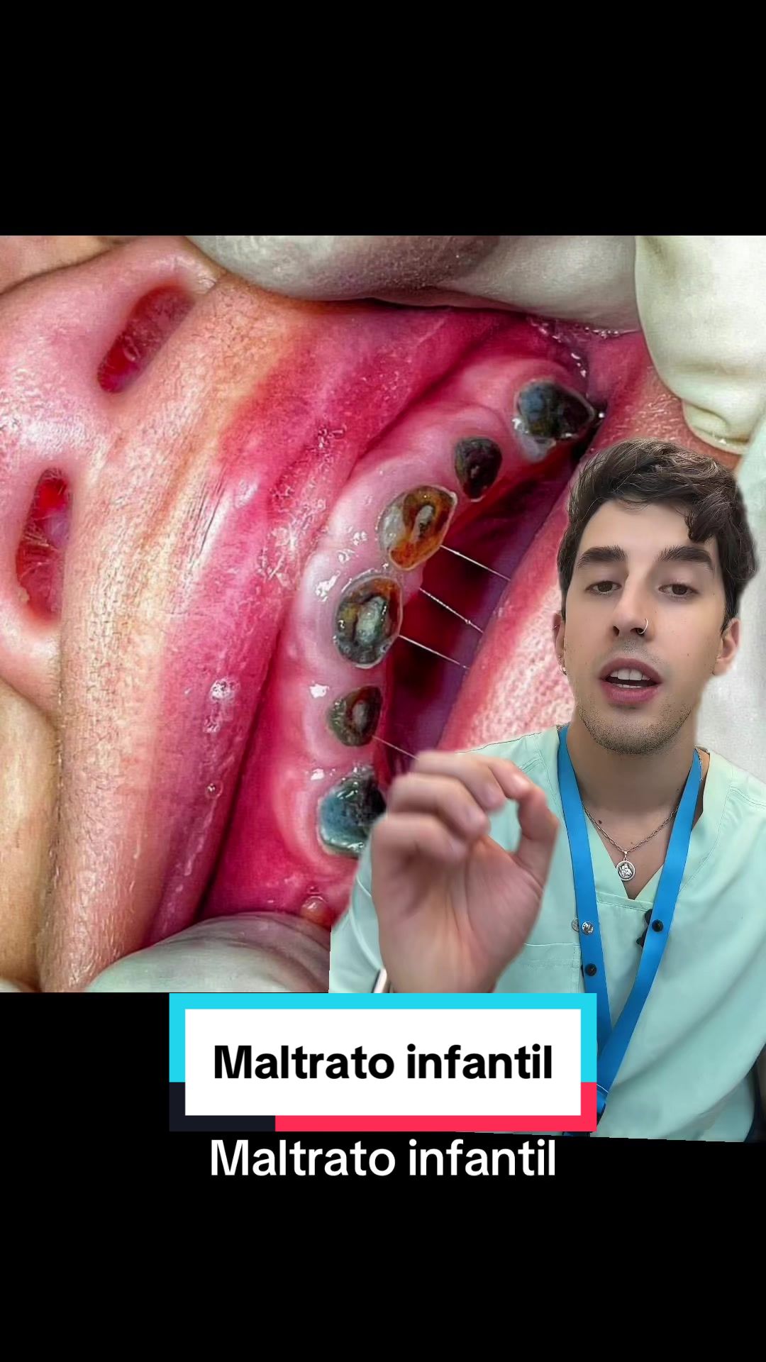 @Mati
