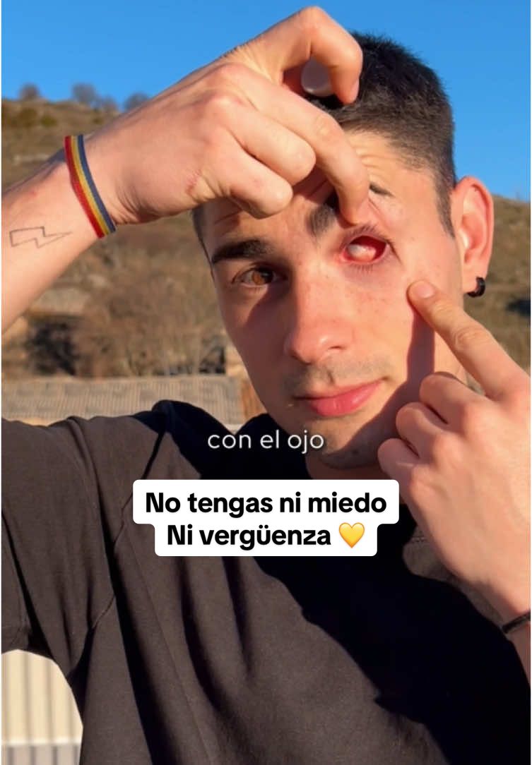 @Cris .)