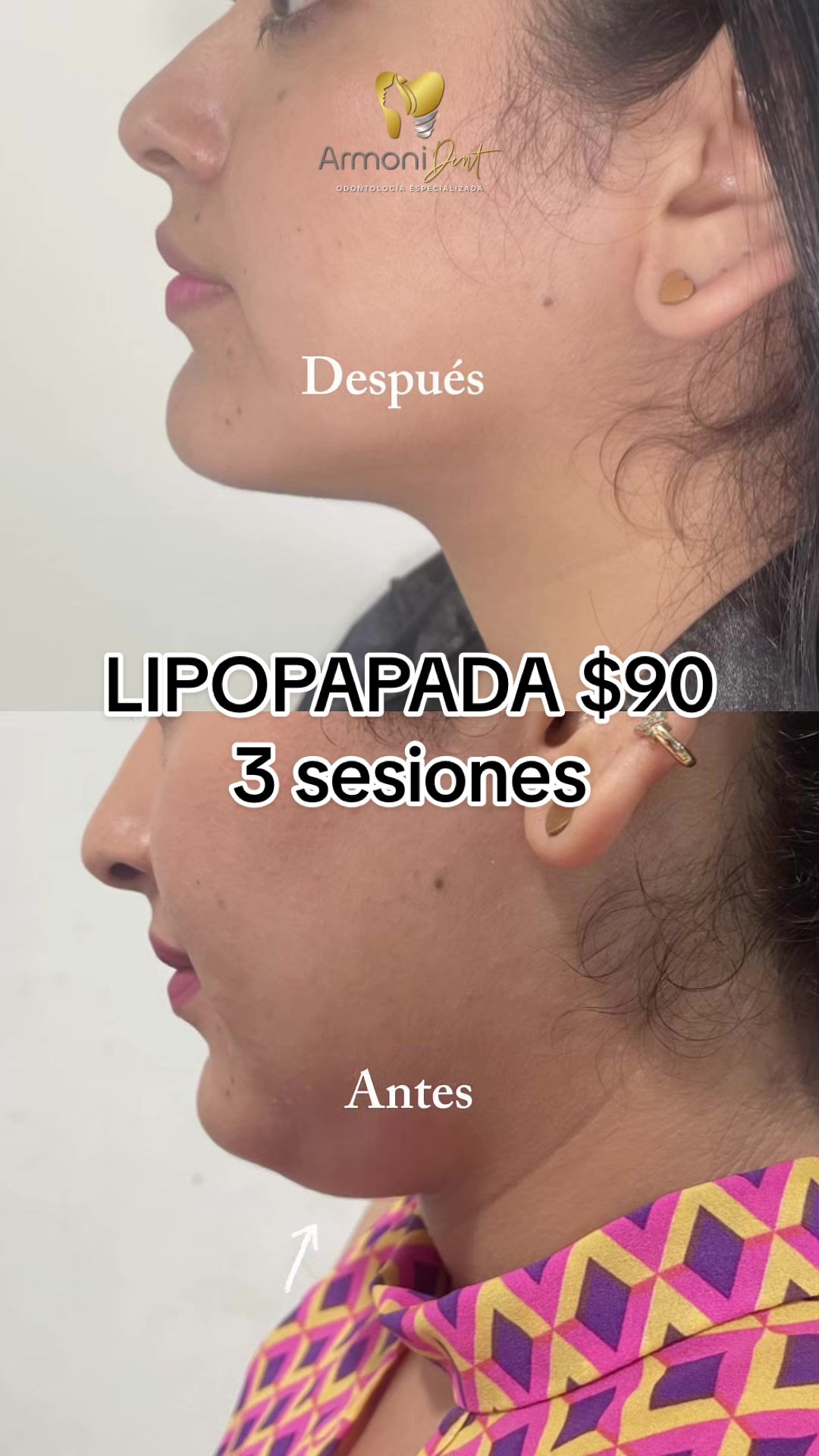 @ARMONI DENT