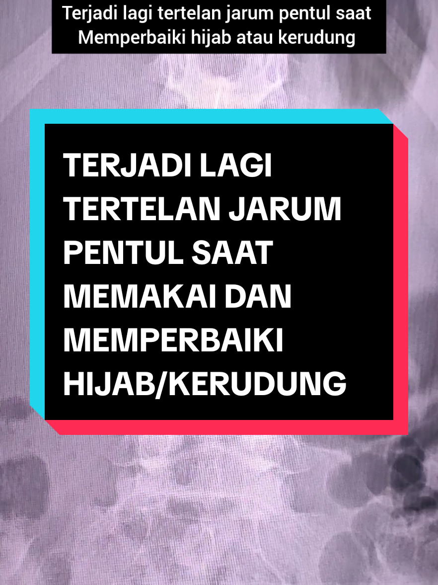 @KAMAR OPERASI