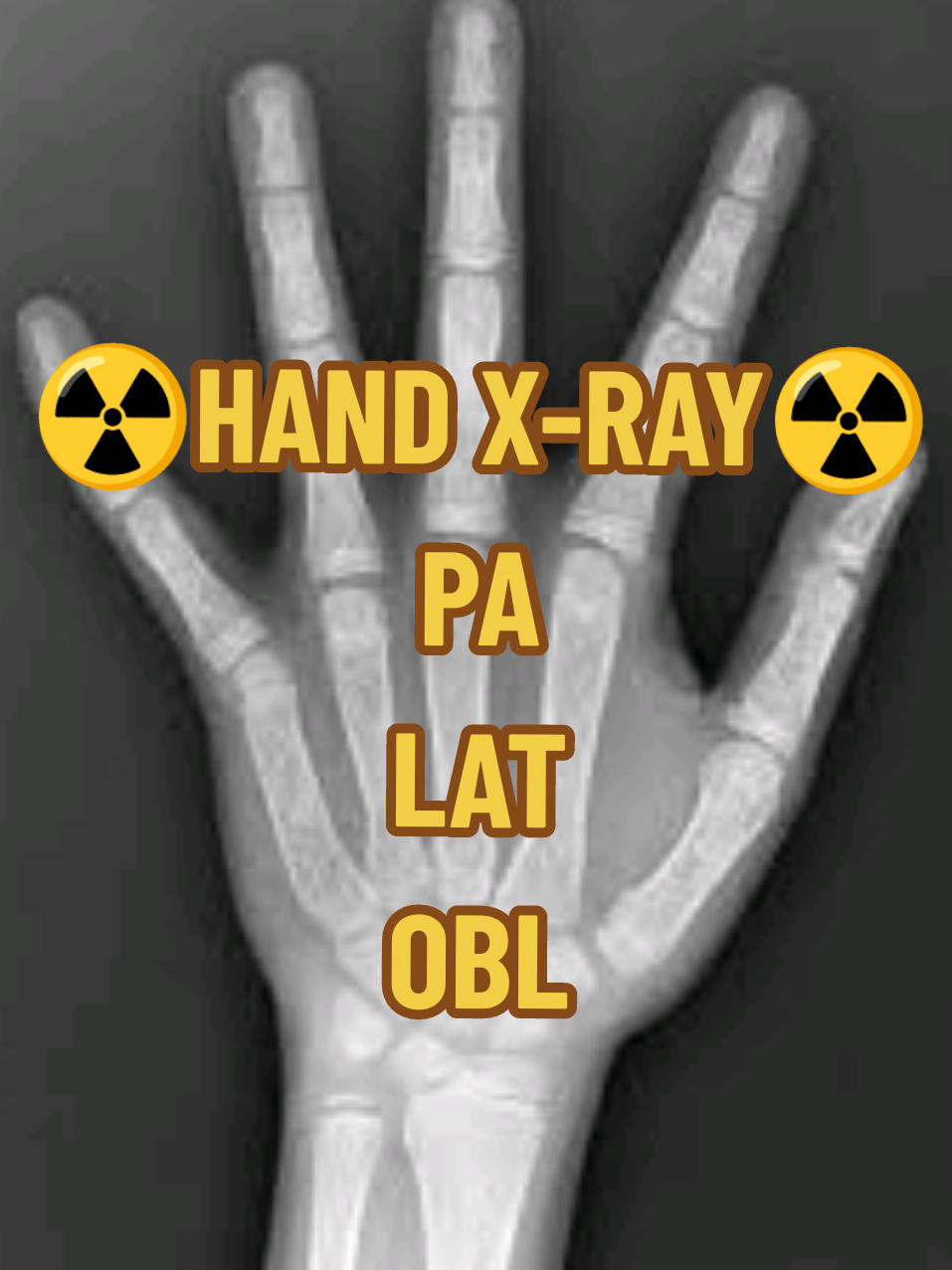 @☢️𝐄𝐒𝐇𝐀𝐄𝐖𝐈 𝐑𝐓☢️