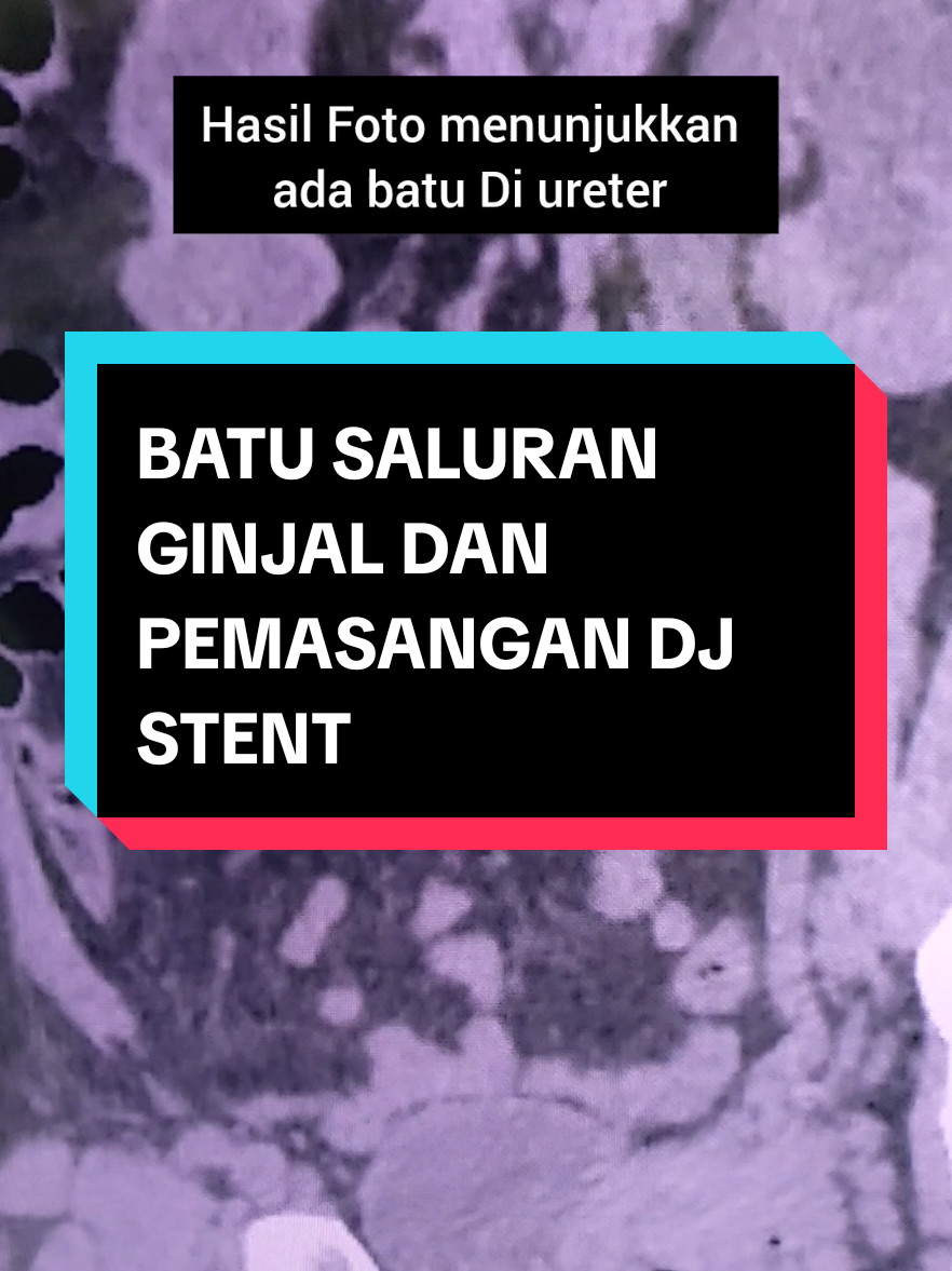 @KAMAR OPERASI