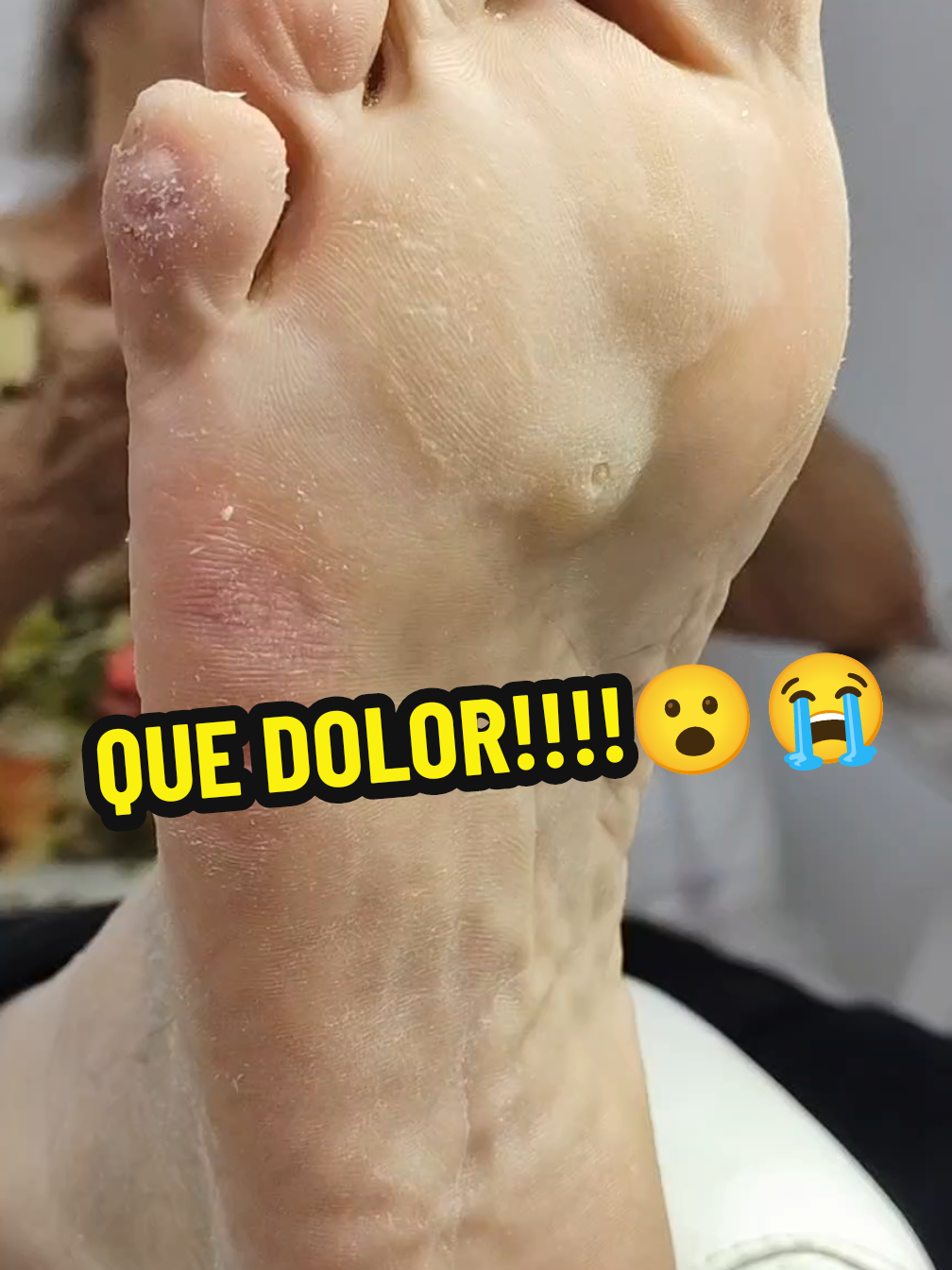 @podolog&iacute;a calzada