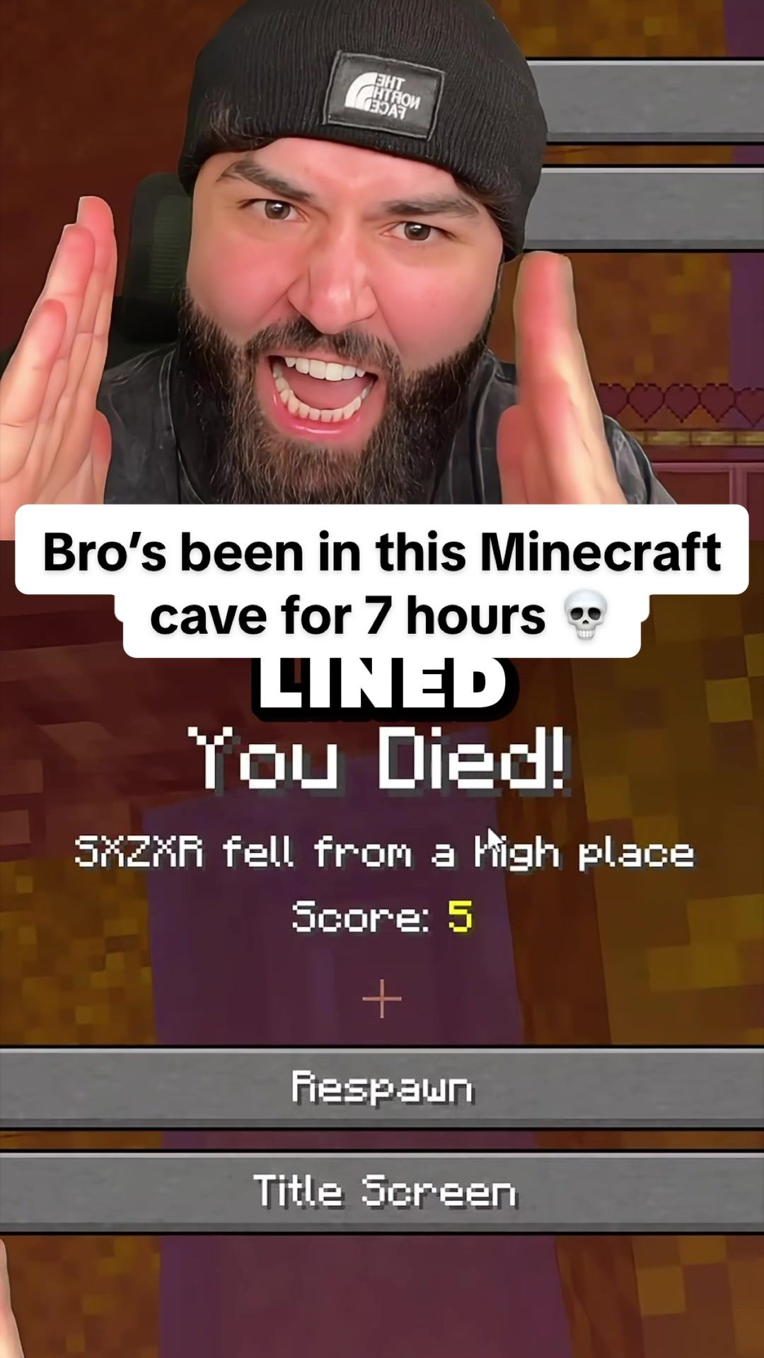 @Sxzxr
