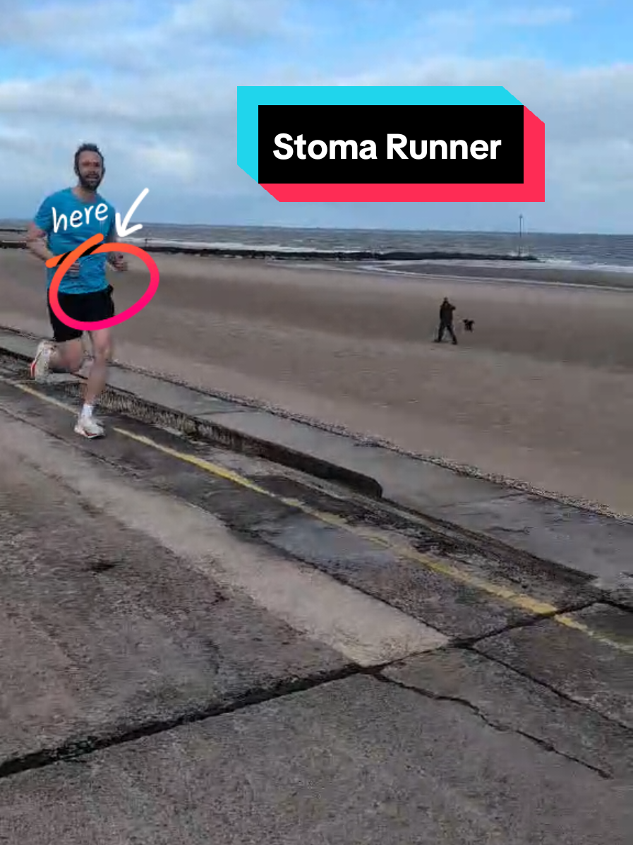 @Running Stoma