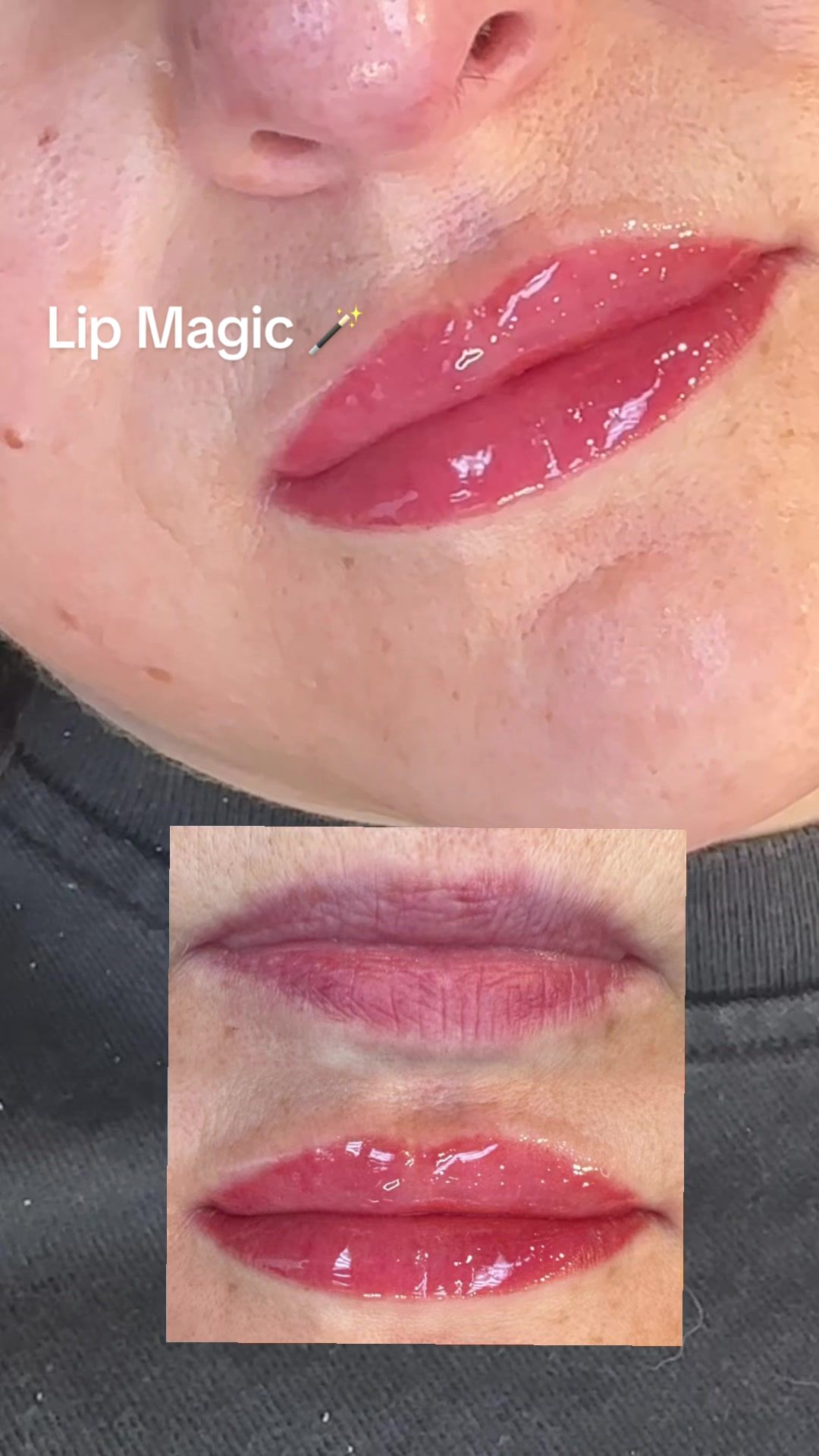 @Lip Junkie