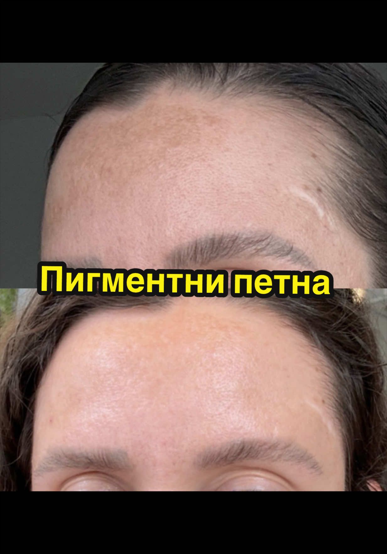@💉👩🏻&zwj;⚕️ СкинТок Дерматолог
