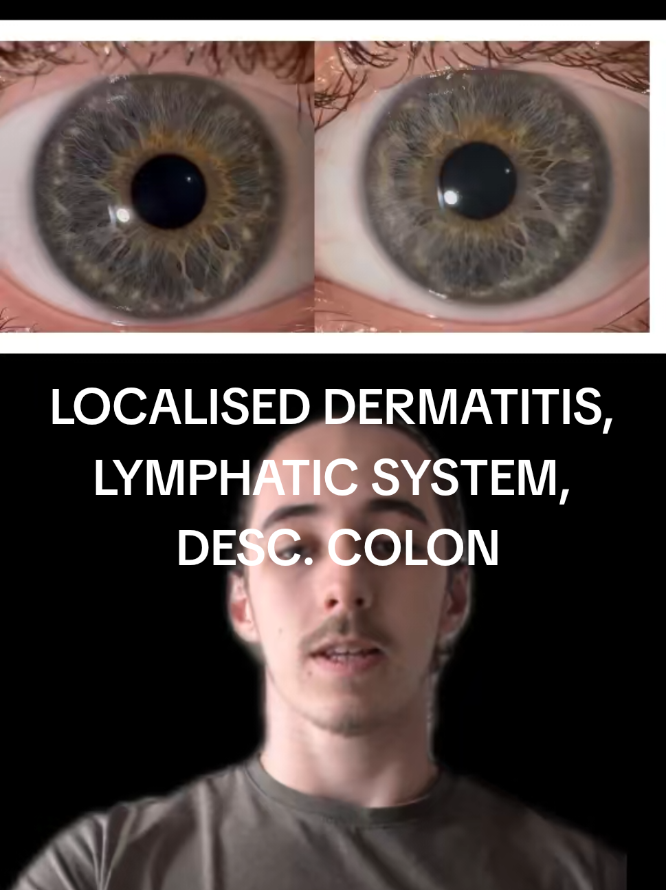 @Oliver | Aajonus' Iridology 👀
