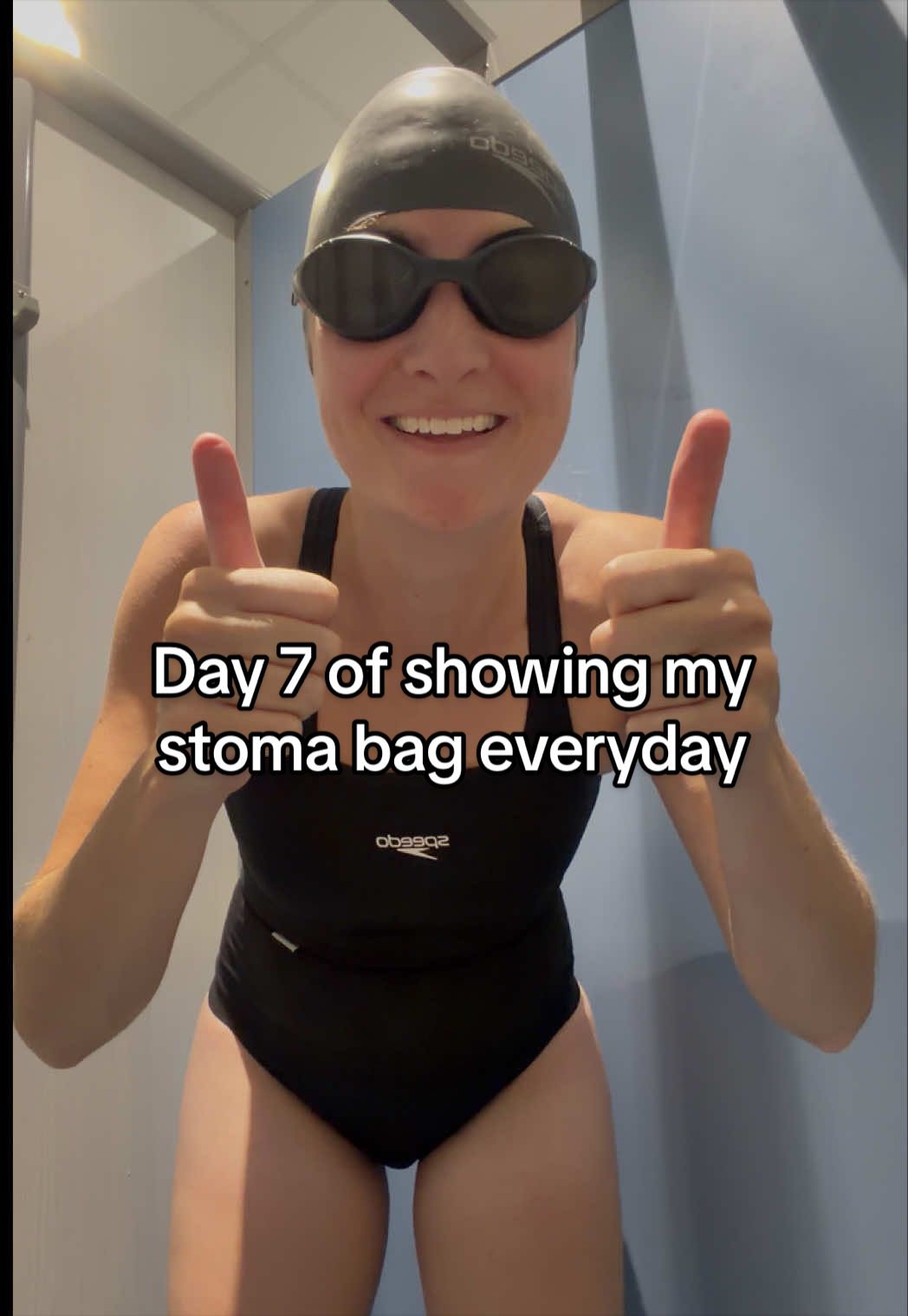 @Louise | Stoma & Crohns