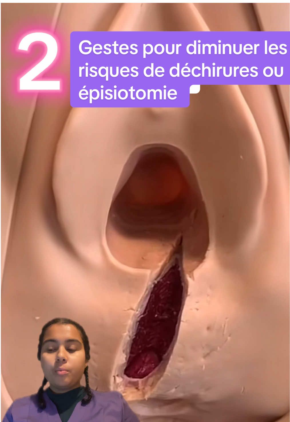 @Philippine | l’osteo des girls