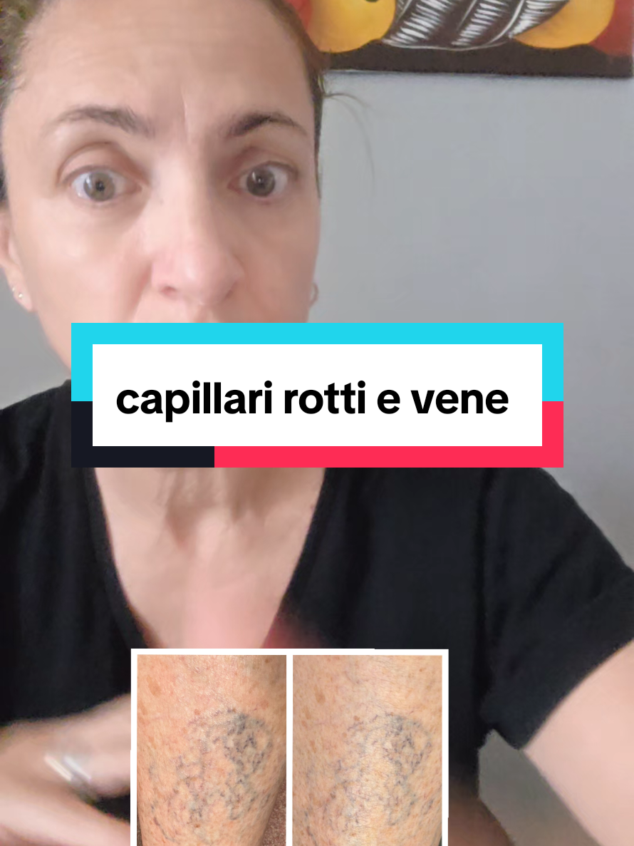 @l'amante del collagene onesta❤