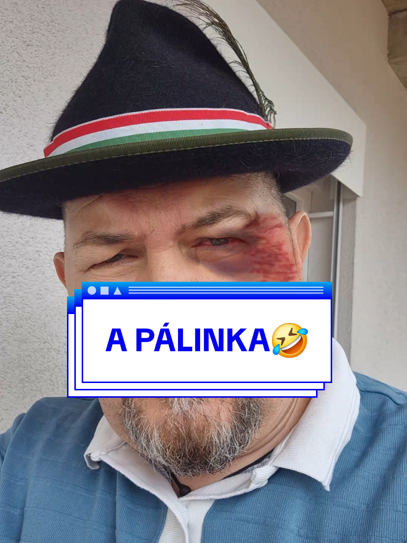 @Benedek Ferkó
