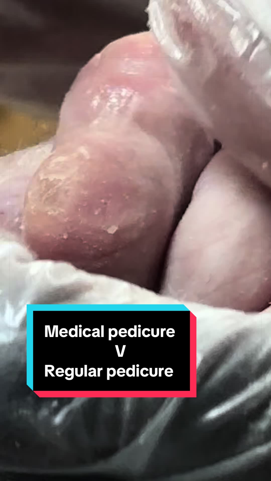 @Sole2Solepod