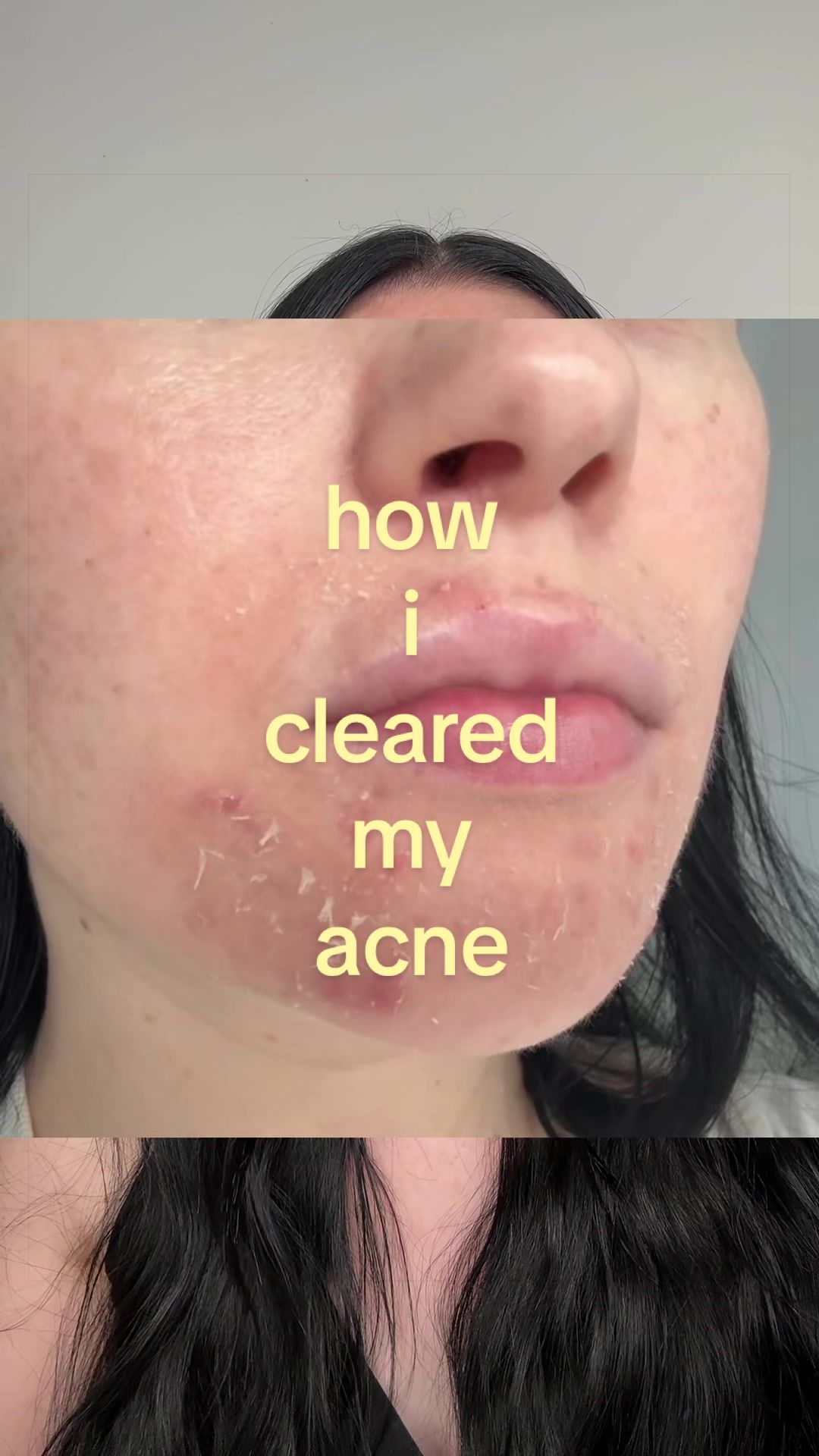 @aoife